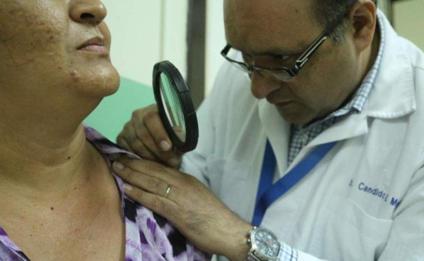 El 3 de abril inicia semana del lunar en el hospital Mario Rivas