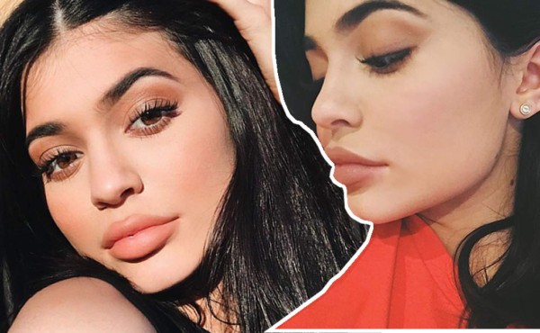 Kylie Jenner inspira a jóvenes para operarse labios