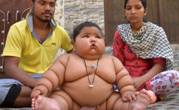 La conmovedora historia de una niña de ocho meses con un peso 38 libras