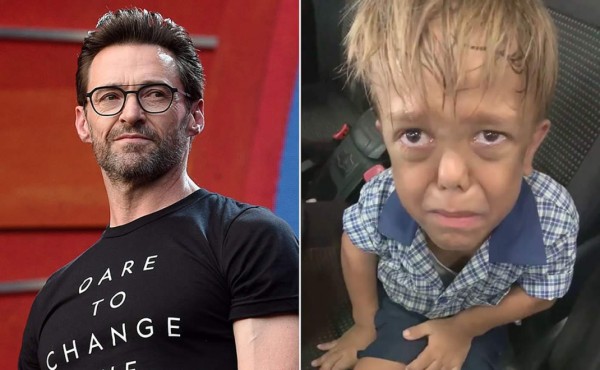 Famosos apoyan a niño con enanismo víctima de bullying