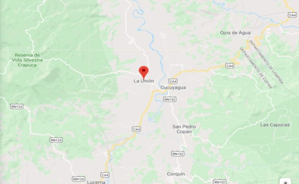 Le infieren un balazo en la cara a una mujer en La Unión, Copán