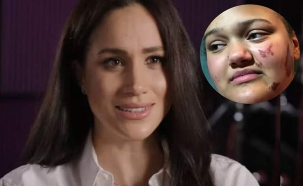 Meghan Markle ayuda a joven que fue quemada en un ataque racista en EEUU