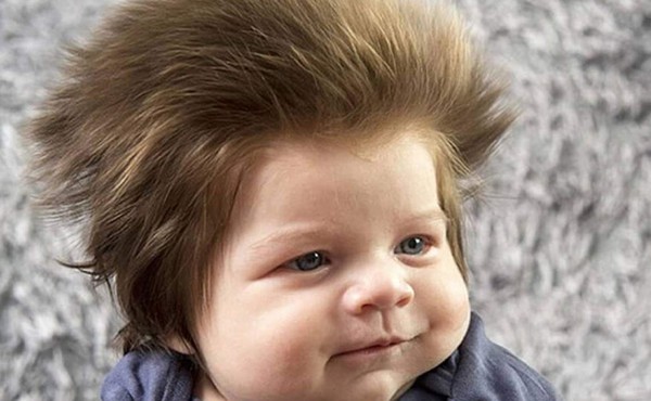 Mirá por qué este bebé enamora las redes sociales