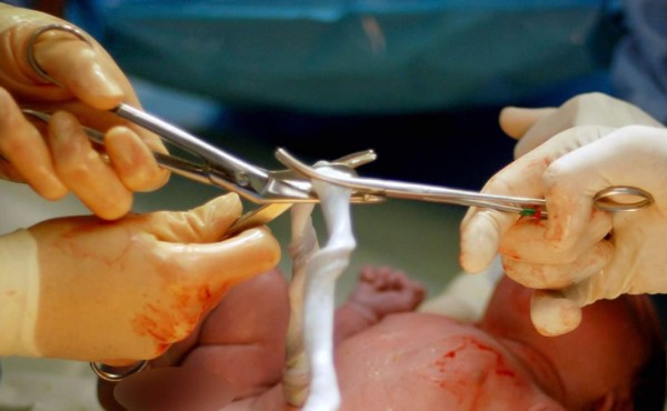 Médico casi le cortó los genitales a bebé