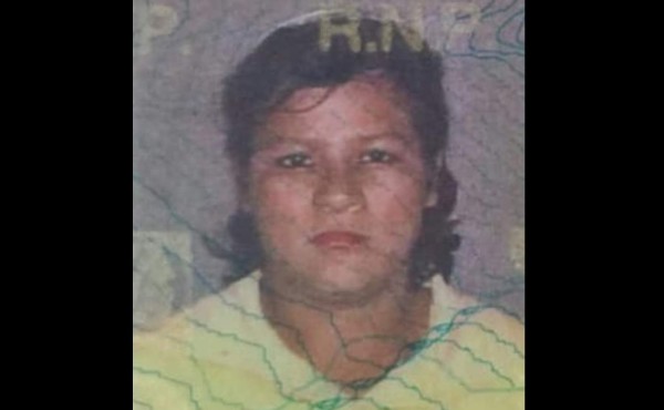 Muere mujer que resultó quemada en explosión de chimbo de gas