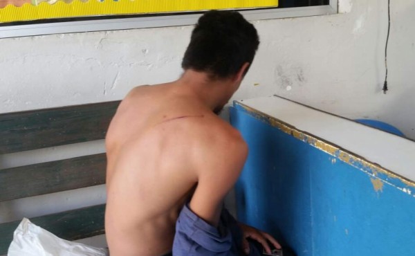 Hombre denuncia que su mujer lo agarra a machetazos