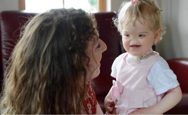Tessa, la niña que nació sin nariz y que cada dos años le hacen una nueva