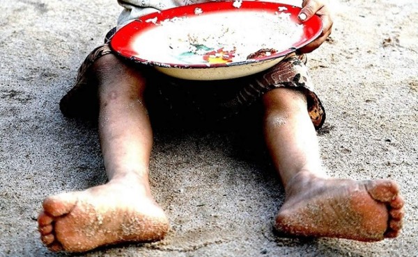 Venezuela: 300 mil niños en riesgo de muerte por desnutrición