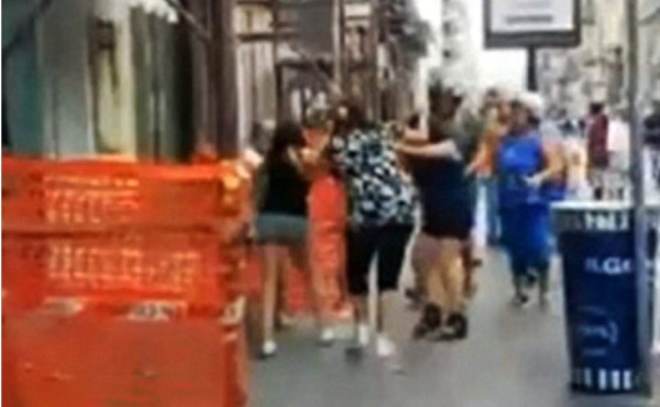 Mujer arranca con los dientes un dedo a la amante del marido