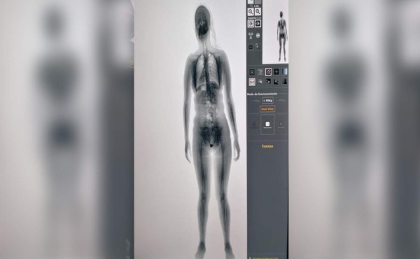 Dentro de sus partes íntimas mujer intentó ingresar droga a El Pozo