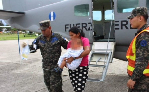 Bebé resulta con graves quemaduras por una sopa instantánea en Olancho