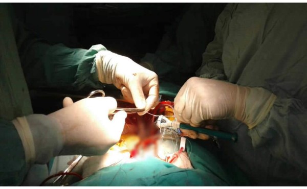 Delicados están cuatro sobrevivientes de la masacre en Tegucigalpa