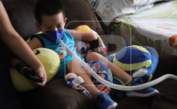 Jesster tiene paralizado el 90% de su cuerpo y su vida depende de un ventilador artificial
