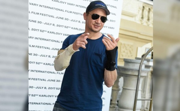 Jeremy Renner se rompió los dos brazos mientras rodaba un filme