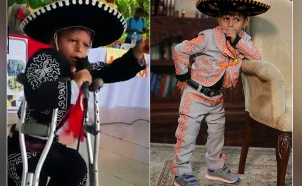 Marlon Yasir fue operado y ya camina sin muletas