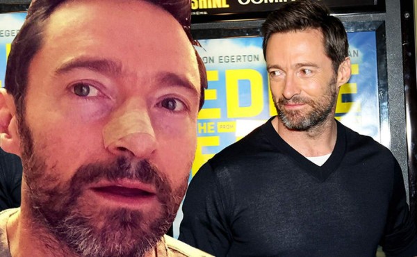 Hugh Jackman, operado por quinta vez de cáncer de piel  