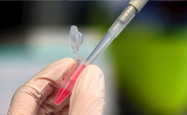 Salud pide participar en ensayos de las posibles vacunas contra el covid