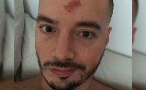 J Balvin se da tremendo golpe durante concierto