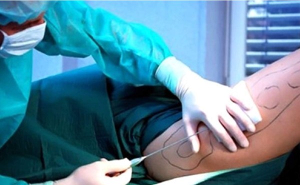 Jardinero deforma a mujer tras hacerse pasar por cirujano