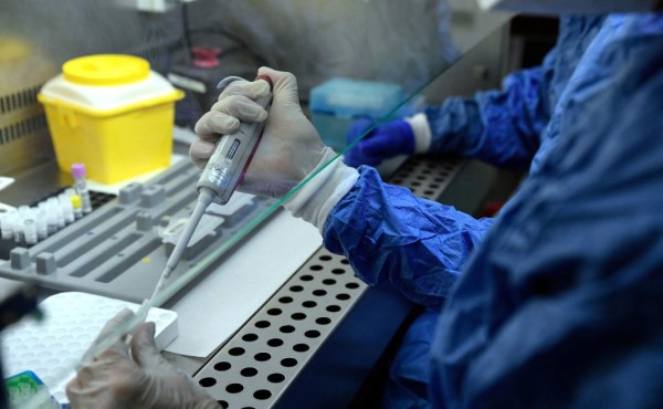 Científicos de EEUU buscan inhibidores de una enzima que ayuda al coronavirus
