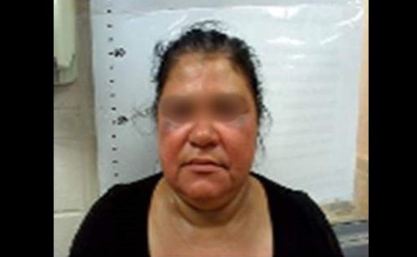 Coyotes dan brutal paliza a migrante hondureña