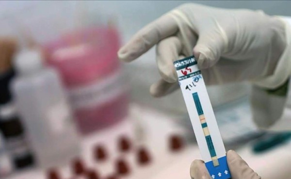 Reportan segundo paciente curado del virus de sida en el mundo