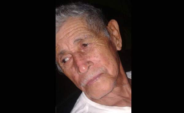 Presidente de patronato muere al ser arrollado por motocicleta