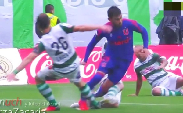 Futbolista sufre escalofriante fractura de tibia y peroné en liga chilena