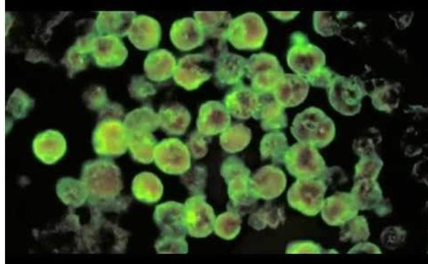 Parásito 'comecerebro' mata a niña de 11 años en EUA