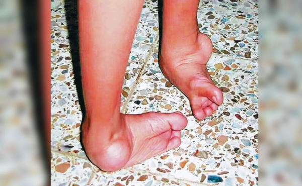 Extranjeros se proyectan con brigada de ortopedia