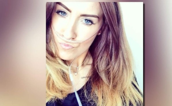 Joven decide morir a los 22 años al sufrir fibrosis quística