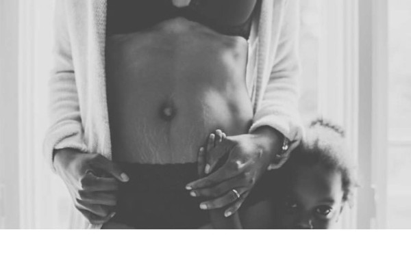 Mujeres comparten fotos de sus estrías para campaña viral