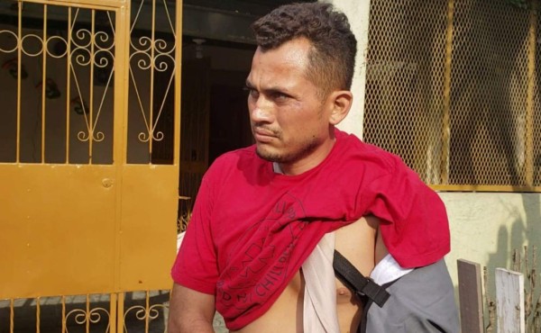 Fiscalía abre investigación en golpiza de policías a demente