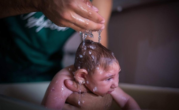 Zika afectará el genoma humano por 2 millones de años: Científicos