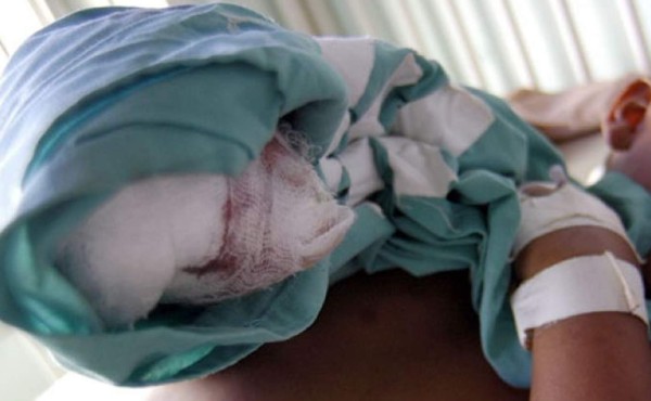 Niño pierde tres dedos de mano izquierda por explosión de mortero