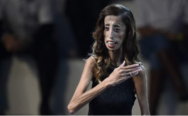 La mujer más fea del mundo, una historia que inspira