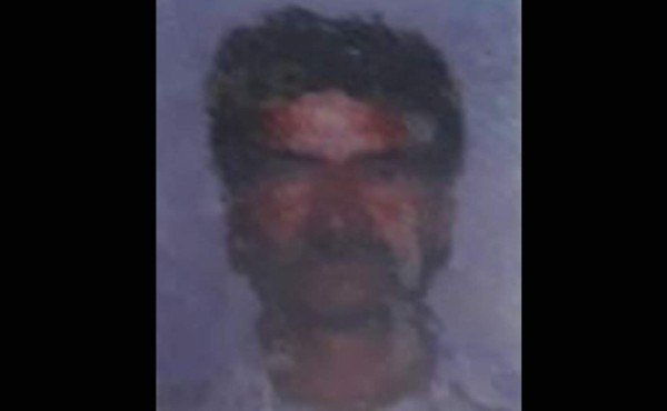 Muere exalcalde herido por sicarios