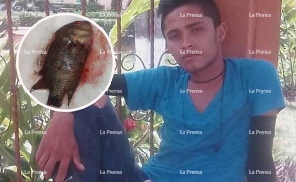 Fallece un joven que accidentalmente se tragó un pescado en Choluteca