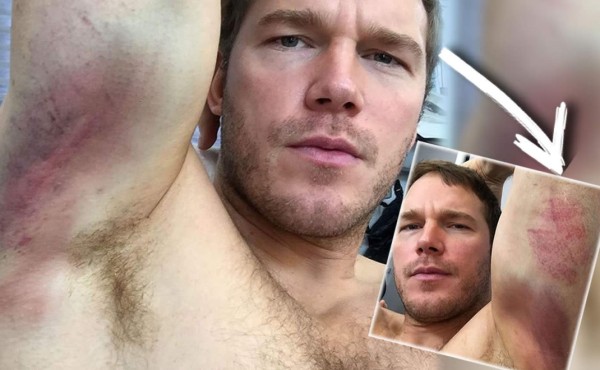 Chris Pratt sufrió rodando 'Passengers'
