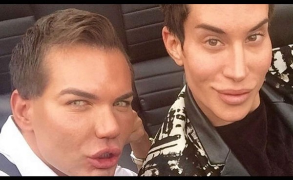 El nuevo Ken humano gastó más en cirugías que los otros dos