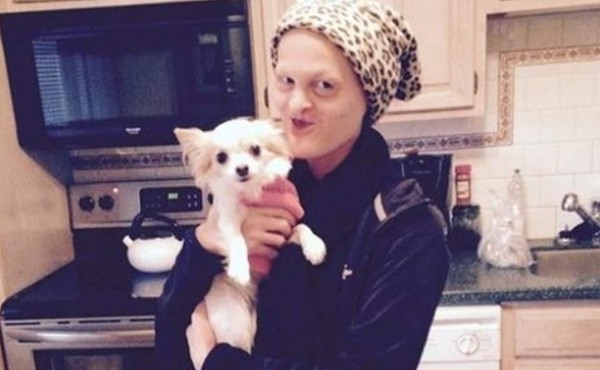 Sin pelo, ni dientes esta modelo revoluciona las pasarelas