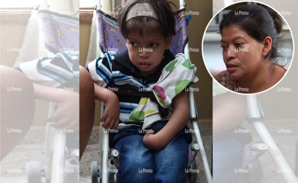 Hondureña lucha por mantener vivo a su hijo que no mira, no camina y tiene hidrocefalia