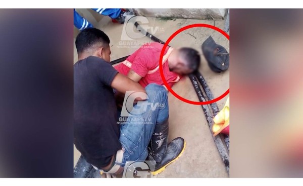 Video: Trabajador de Patuca III se incrusta varilla en la cabeza