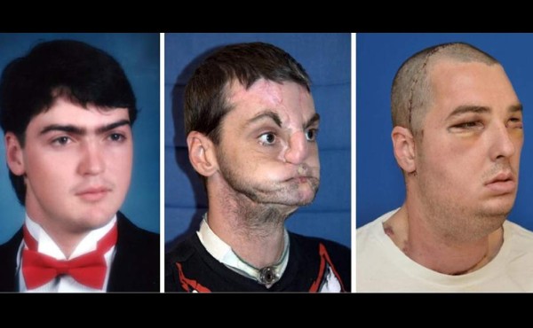 Mujer vuelve a ver el rostro de su hermano muerto