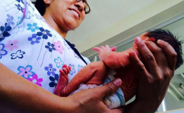 Nace el primer bebé con microcefalia en el mes de mayo