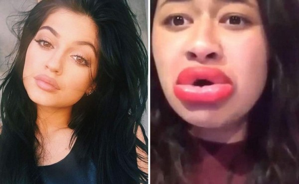Mira los horribles resultados del #KylieJennerChallenge