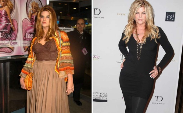 Famosos con drásticos cambios de peso