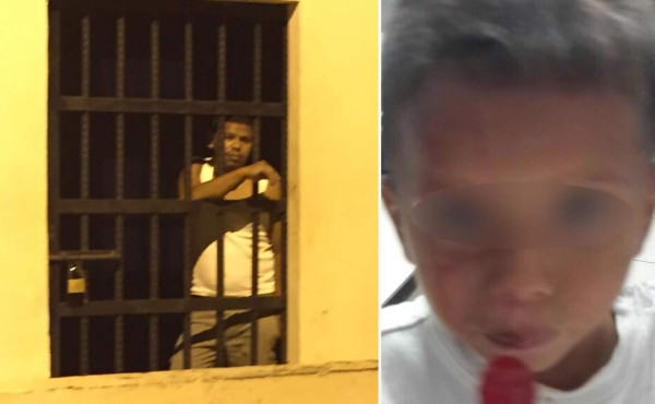 A prisión por darle fajazo en el rostro a su sobrino