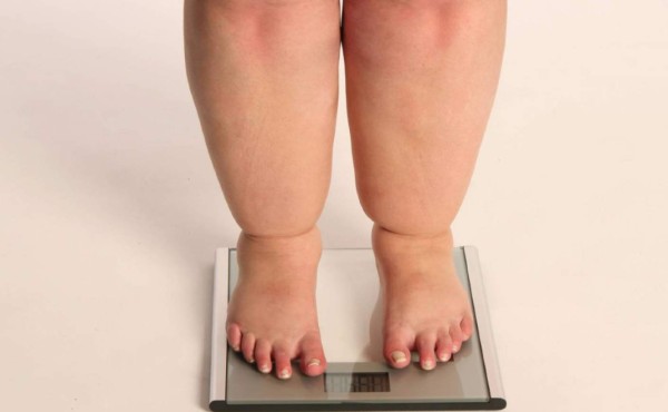 ¿Padecer de sobrepeso puede disminuir la fertilidad?