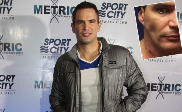 Julio Camejo fue herido con arma blanca